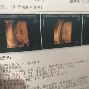 怀孕初期看男女准确度 想准确知道宝宝男女,怀孕多久可以?这里有答案!