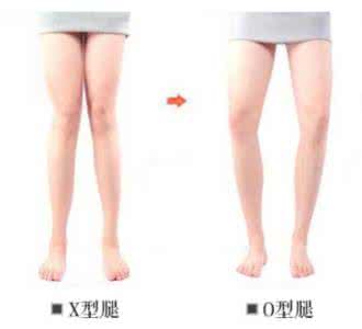 腿型如何矫正 如何美腿？不美观腿型大盘点