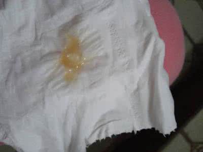 血色白带 血色的白带是什么原因?