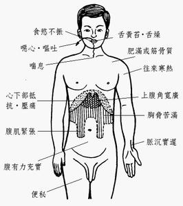 胆囊炎引起的胰腺炎 胆囊炎 胰腺炎方