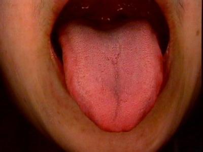 看舌头知健康 望舌知健康