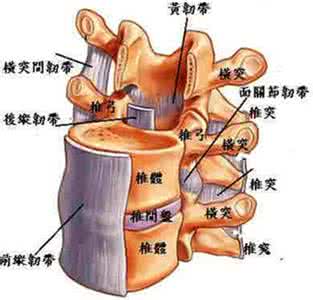 颈腰椎间盘突出症治疗 混元膏为主治疗颈腰椎间盘突出症