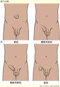 美女腹部外科手术视频 医学美图联播 l 外科手术（51图）