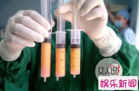 抽脂减肥手术要多少钱 抽脂手术 抽脂减肥要多少钱