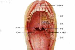 口腔结核性溃疡 口腔结核性溃疡 结核性溃疡 保持口腔卫生是治疗的关键