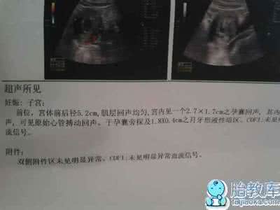 怀孕60天孕囊图片 怀孕60天孕囊大小
