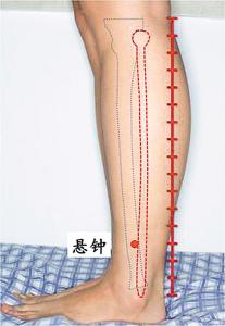 中风偏瘫针灸一针特效 中风康复,灸灸悬钟穴