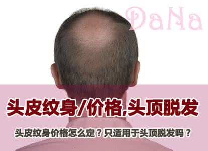 女性脱发会秃顶吗 脱发秃顶怎么办 （女性脱发）产后突然秃顶，就因为每天做的这件事