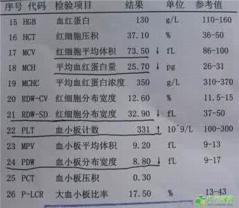 一篇文章看懂伞形信托 化验单像天书？一篇文章让你懂