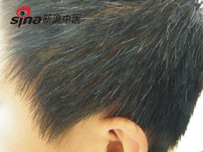 白发变黑发小妙招 三招白发变黑发不再做“少白头”