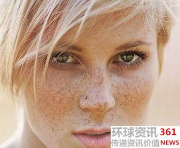 辐射斑长什么样 人为什么会长辐射斑呢