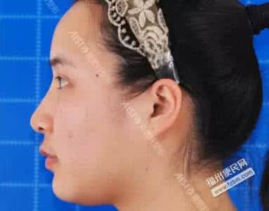 女人突然头晕恶心想吐 头晕想吐是怎么回事 女人经常头晕恶心是怎么回事?