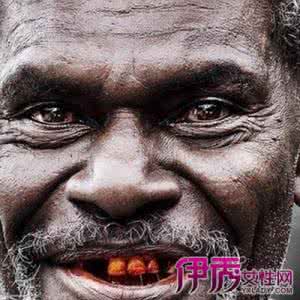 槟榔的危害 槟榔 槟榔的危害