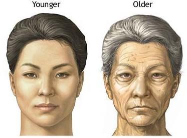 去除老年斑的偏方大全 快速去掉老年斑 去老年斑的偏方大全