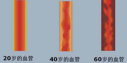 老年人血液粘稠怎么办 老年人如何防治血液粘稠