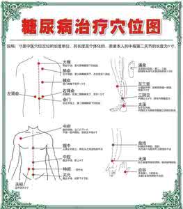 糖尿病按摩降血糖图解 糖尿病的穴位疗法