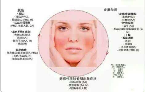 怎样改善敏感性皮肤 敏感性皮肤怎样护理