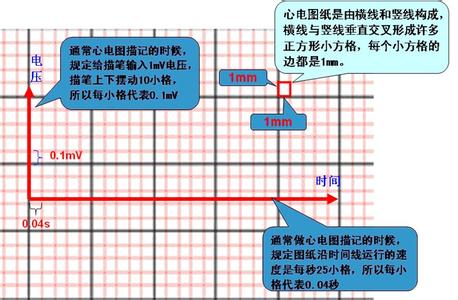 心电图查房病例精讲 心电图的基本操作和识别精要