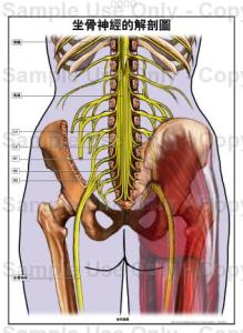 治疗坐骨神经痛费用 不費一文錢，我治好了坐骨神經痛