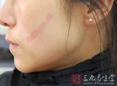 富德生命康健无忧不好 脸上有这东西一生命不好