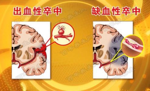 养生堂笔记 养生堂20151023视频和笔记:小中风大危害,一过性脑缺血