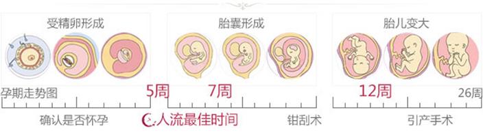 什么时候人流最佳时间 人流的最佳时间段是什么时候