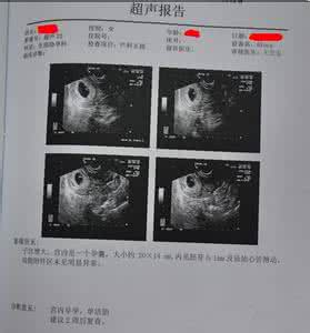 怀孕7周b超能看到什么 怀孕5周b超能看到吗 怀孕六周b超可以看到什么