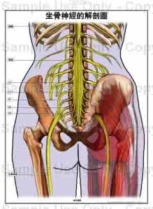 坐骨神经痛中医 坐骨神经痛试试国粹中医的方子
