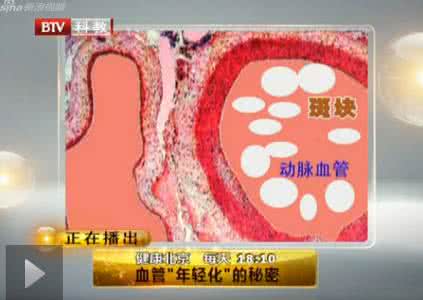 心脑血管疾病年轻化 血管“年轻化”的秘密图解