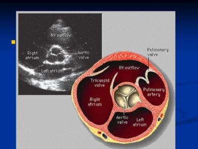 超声心动图 再探超声心动图！这三个经典切面你必须知道