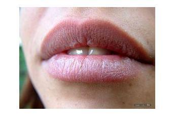 嘴唇经常干裂怎么办 ?终于找到嘴唇老是干裂的原因了！赶快收藏