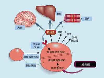 胰岛素抵抗的原因 什么是胰岛素抵抗 胰岛素抵抗原因及治疗