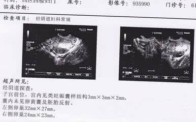 350万年前病毒 研究决定胎儿性别是150万年前古老病毒