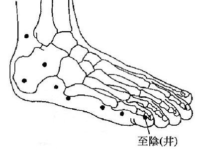 艾灸胎位不正纠正图 艾灸至阴穴治疗胎位不正80例_陈英