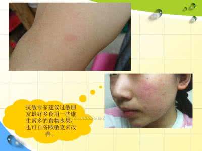 负面情绪 累积负面情绪 小心惹来皮肤病