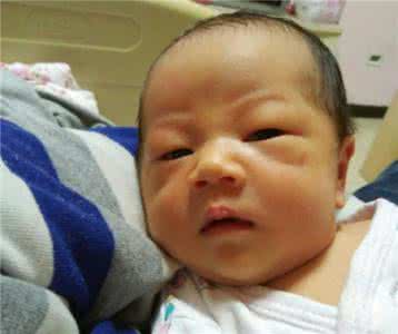 如何判断母乳性黄疸 如何判断母乳性黄疸 治疗方法有哪些