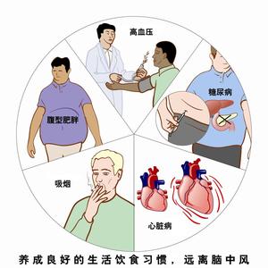 脑卒中的危险因素 脑卒中危险因素较多 改变生活方式是预防前提