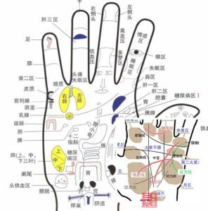 高血脂与糖尿病 糖尿病掌纹 看眼睛能看出高血脂信号？真的！看掌纹可预测糖尿病？不靠谱！