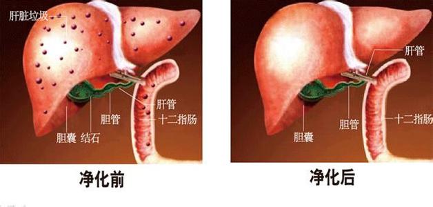 人体排出的垃圾毒素图 人体排出的垃圾毒素图 排出7种毒素 抗衰老更年轻