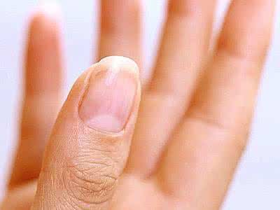 指甲上半月痕 指甲半月痕 指甲上的半月痕你懂多少？指甲半月痕与健康吉凶