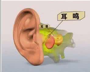 突聋治疗最佳方案 如何治疗突发性耳聋