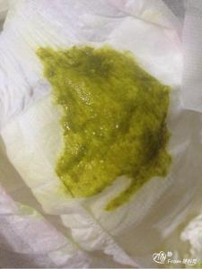 几天没有大便吃什么药 几天没大便了吃什么药？