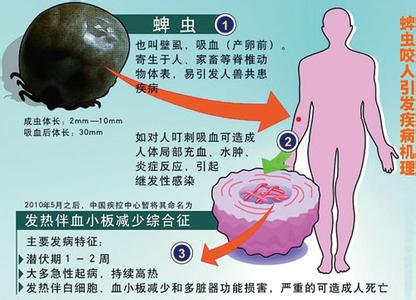 蜱虫叮咬症状 穿浅衣应对蜱虫叮咬