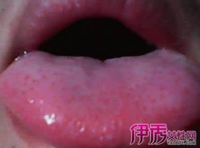 舌头上有小红点很疼 关于舌头上有小红点很疼的原因