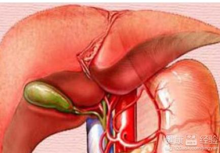 胆囊息肉的症状及治疗 胆囊息肉症状 这些表现就是胆囊息肉