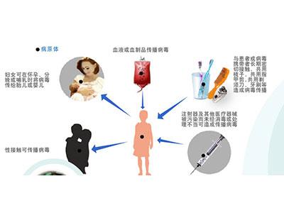 黄疸肝炎的治疗方法 黄疸肝炎是什么 黄疸肝炎的治疗和预防