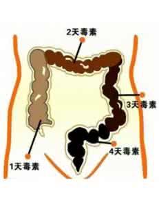 宿便怎么快速清除掉 旋掉宿便，让你无毒一身轻