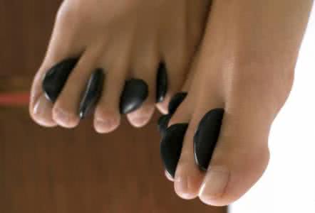 如何治疗脚臭脚汗 怎么治出脚汗 脚臭怎么办 教你除臭方法