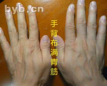 鼻子上有青筯宝宝 手掌青筯、斑点与身体青筯的辩病