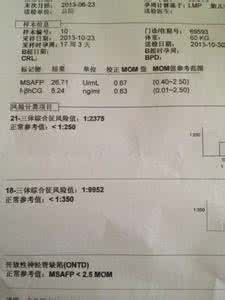 唐氏筛查高危的原因 如何判断是否唐氏筛查高危